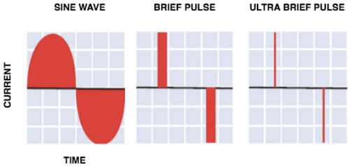 Sine Wave, Brief Pulse, and Ultra Brief Pulse ECT