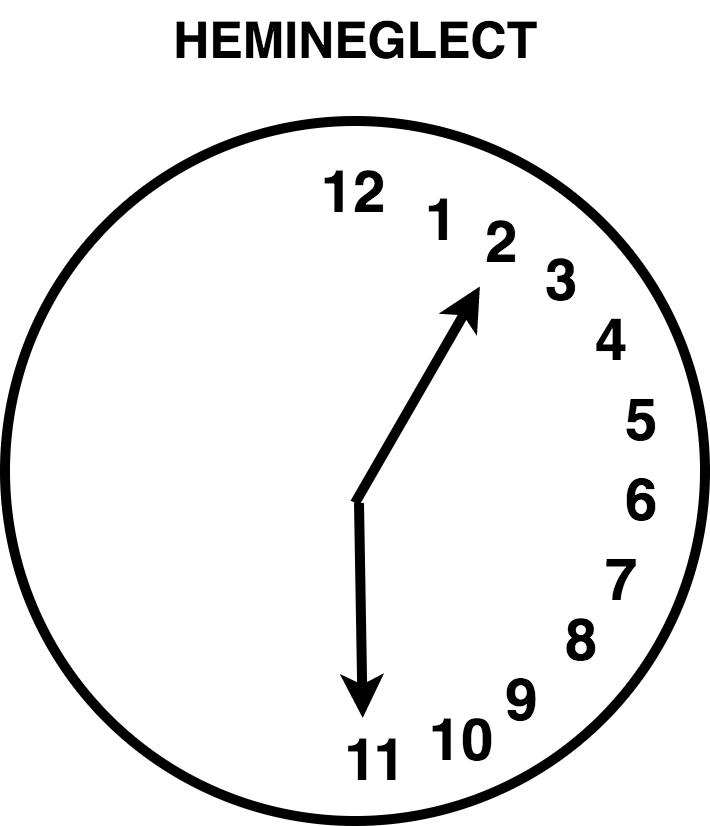 Clock-Drawing Test (CDT) - PsychDB