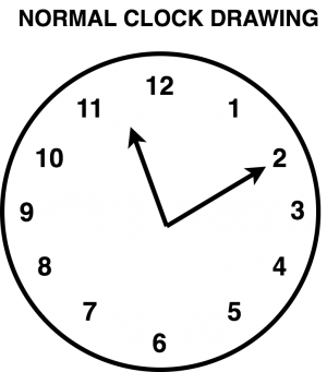 Normal clock drawing