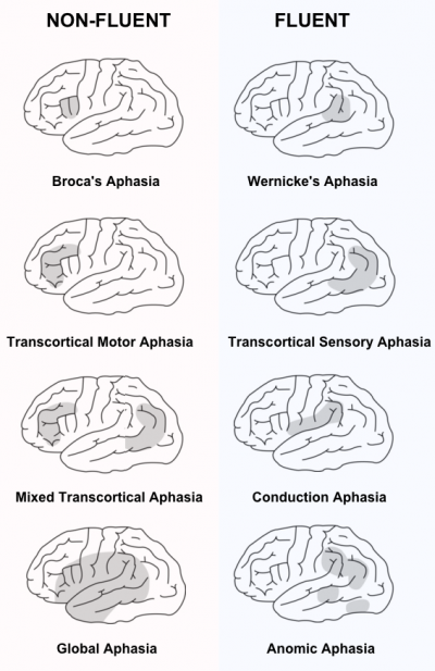 Fluent and Non-Fluent Aphasias