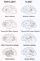 neurology:approaches:aphasia.png