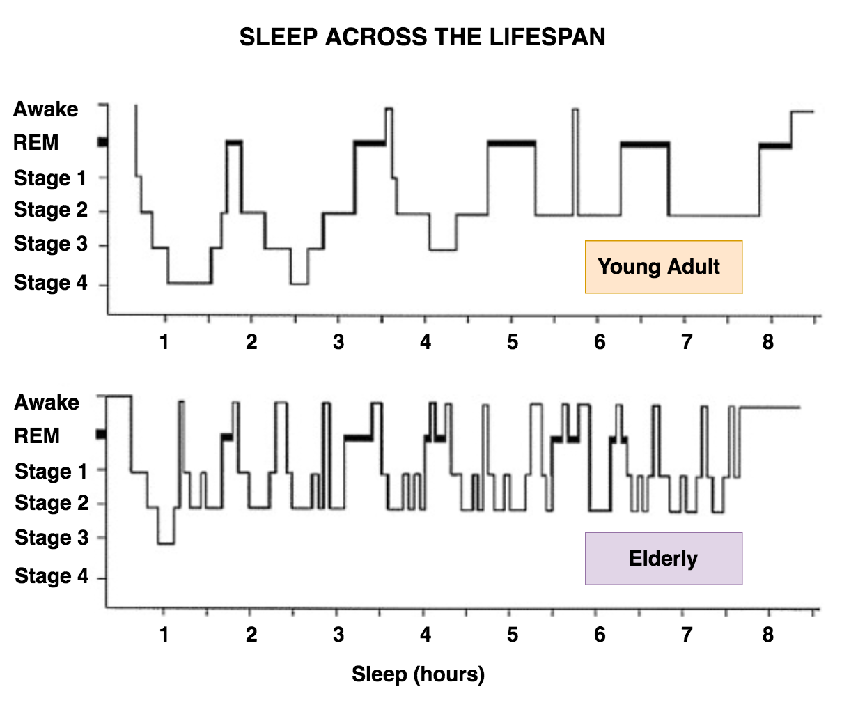 Hypnogram Comparing Sleep Across the Lifespan
