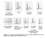 on-call:schematic_of_atrial_repol_wave_from_my_book.png